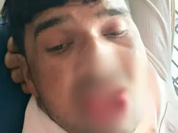 SmartKhabari's tweet image. कानपुर में जबरन किस करने पर युवती ने जीभ काटी: छटपटाते हुए जीभ का टुकड़ा हाथ मे लेकर पहुंचा डॉक्टर के पास।

कानपुर देहात के एक गांव में उस वक्त हड़कंप मच गया जब एक युवती ने आत्मरक्षा में मनचले की जीभ ही काट डाली। जीभ दो टुकड़ों में बंट गई और खून का फव्वारा छूट पड़ा।

बिल्हौर थाना…