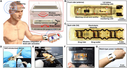 corinacirco's tweet image. SID wirelessly integrated with wearable devices.

pmc.ncbi.nlm.nih.gov/articles/PMC77…