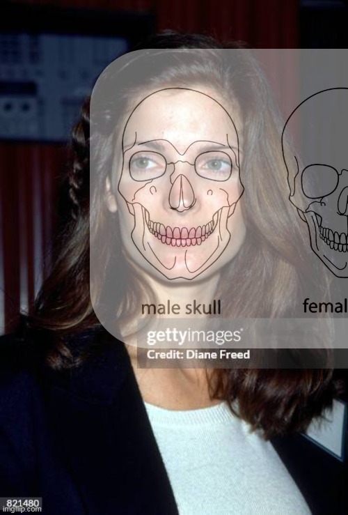 MichaelJamesFr8's tweet photo. Awful song with 2.4 billion views on YouTube.
#StephanieSeymour #AxlRose #NovemberRain #Fletch2 #FletchLives
Male skull. Super flat male back on display in Fletch 2.
https://t.co/yct2eVkAlG https://t.co/35ENBn9o2t
