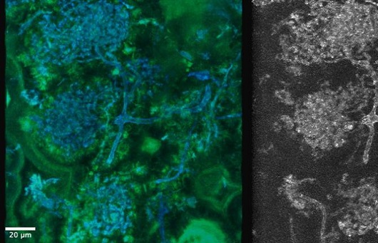 RadioAllen's tweet image. #Research: Scientists discover new species of fungus in 407-million-year-old plant fossil from Scotland