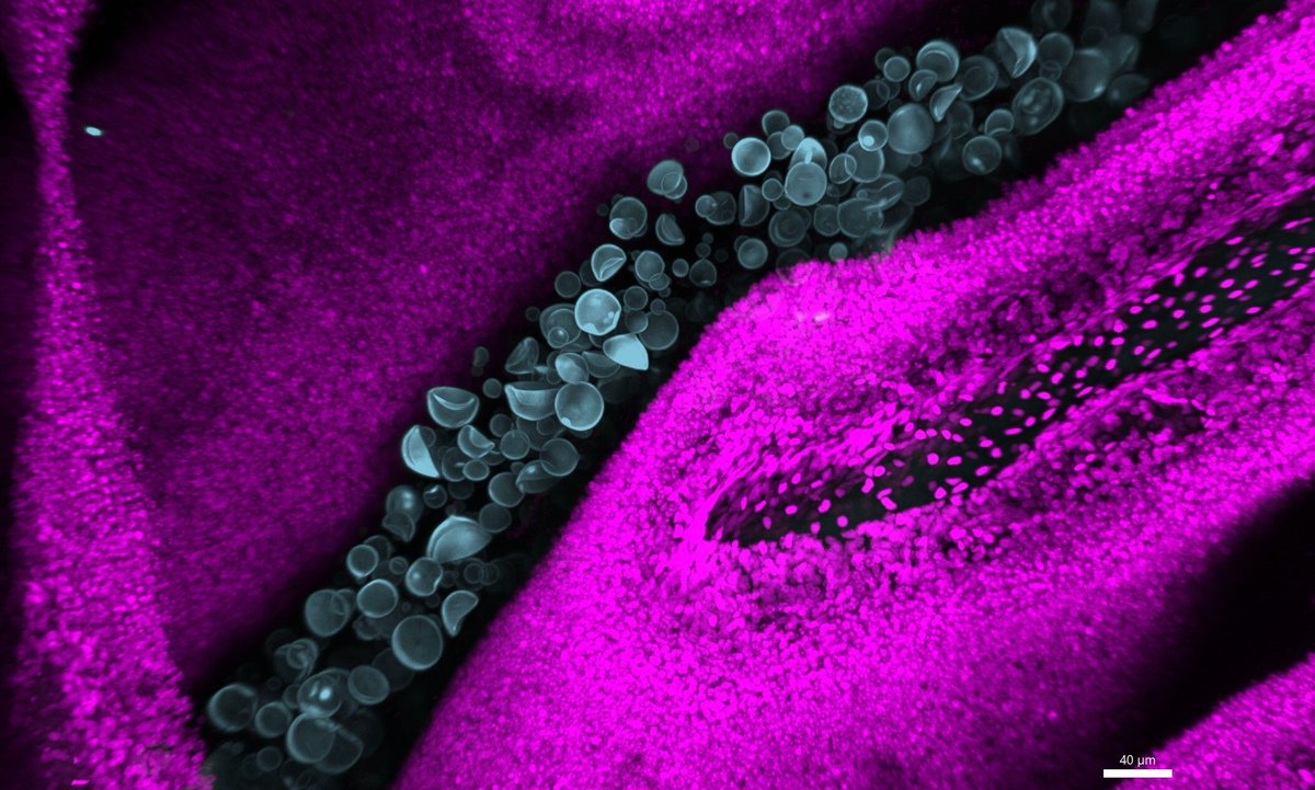 MRCcmm's tweet image. #ImageOfTheWeek ¦ The Fungal Superhighway 🧫

Cryptococcus neoformans (blue) moving through mouse nose tissue (pink). This image is the first time it’s been seen in this formation in the airways. 

📸 @Ness_Francis88 MRC Centre for Medical Mycology
 
#FungalInfection #Mycology