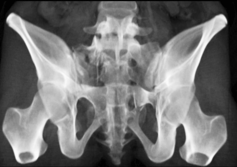 ML Chip Routt tweet media