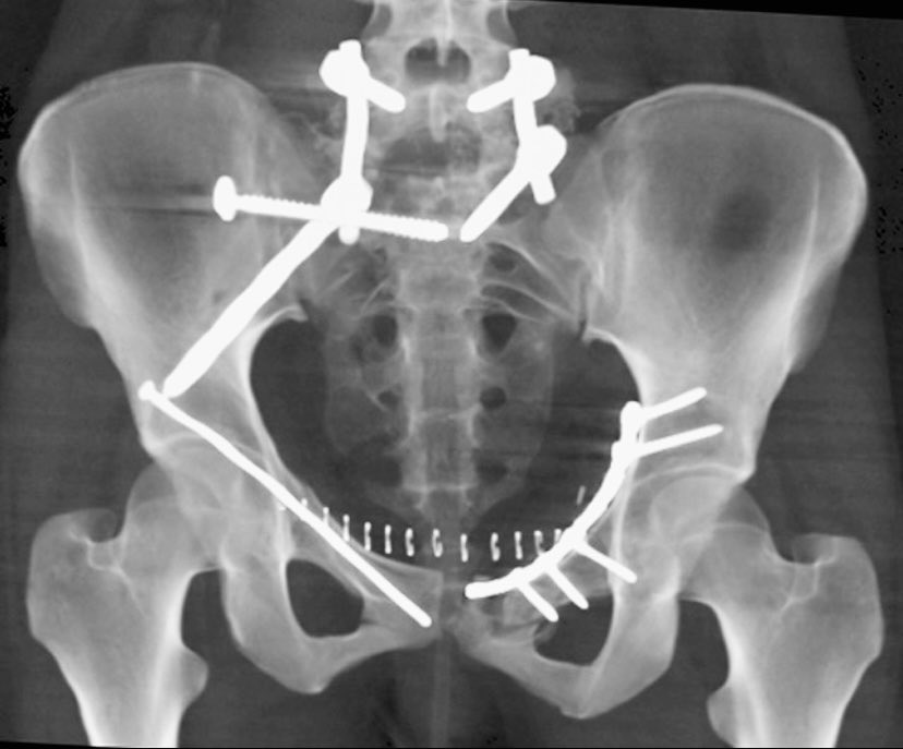 ML Chip Routt tweet media