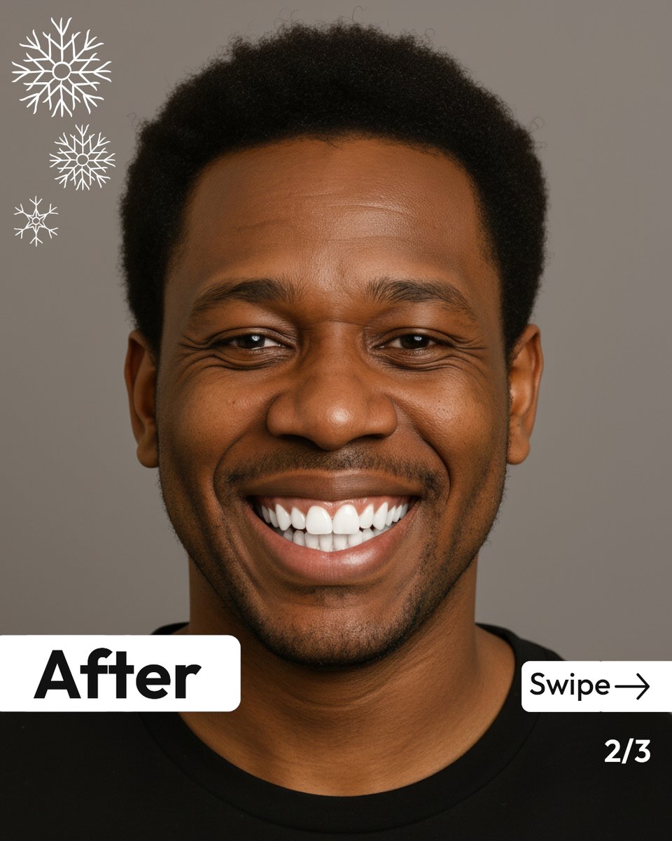 heybriando's tweet photo. 2025 targets demolished.

Promotion ✅
New clients ✅
Skills upgraded ✅  

But the one thing you said you'd handle "when things settle down"?  The smile. 

Every video call.
Every client meeting. 
See what's possible in 60 seconds.  

Comment "Smile" to get the FREE sim link. https://t.co/BARNvQN4K3