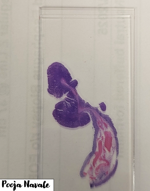 navale_pooja's tweet photo. When the slide basically signs itself out before you even look under the scope 😎🔬 Beautiful embedding deserves its own journal acceptance @CooperPathology 

#pathtwitter #GIpath https://t.co/aRnXek8nqm
