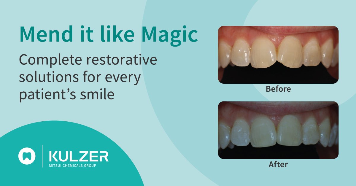 Kent_Express's tweet image. From innovative filling materials and excellent adhesive systems, up to the appropriate accessories, Kulzer offers you everything that you need for high quality, durable restorations with outstanding aesthetics.

Enjoy free next day delivery on Venus Pearl, Charisma ABC and more…