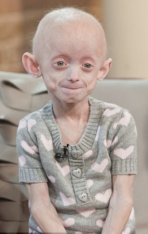 Doctors_GUILD's tweet image. This individual is seven years of age, what is your diagnosis?