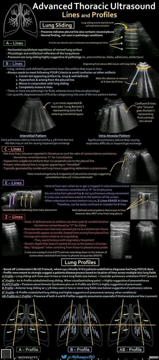 mznljrdy47597's tweet image. Advanced Thoracic Ultrasound

#ultrasound #sonologist