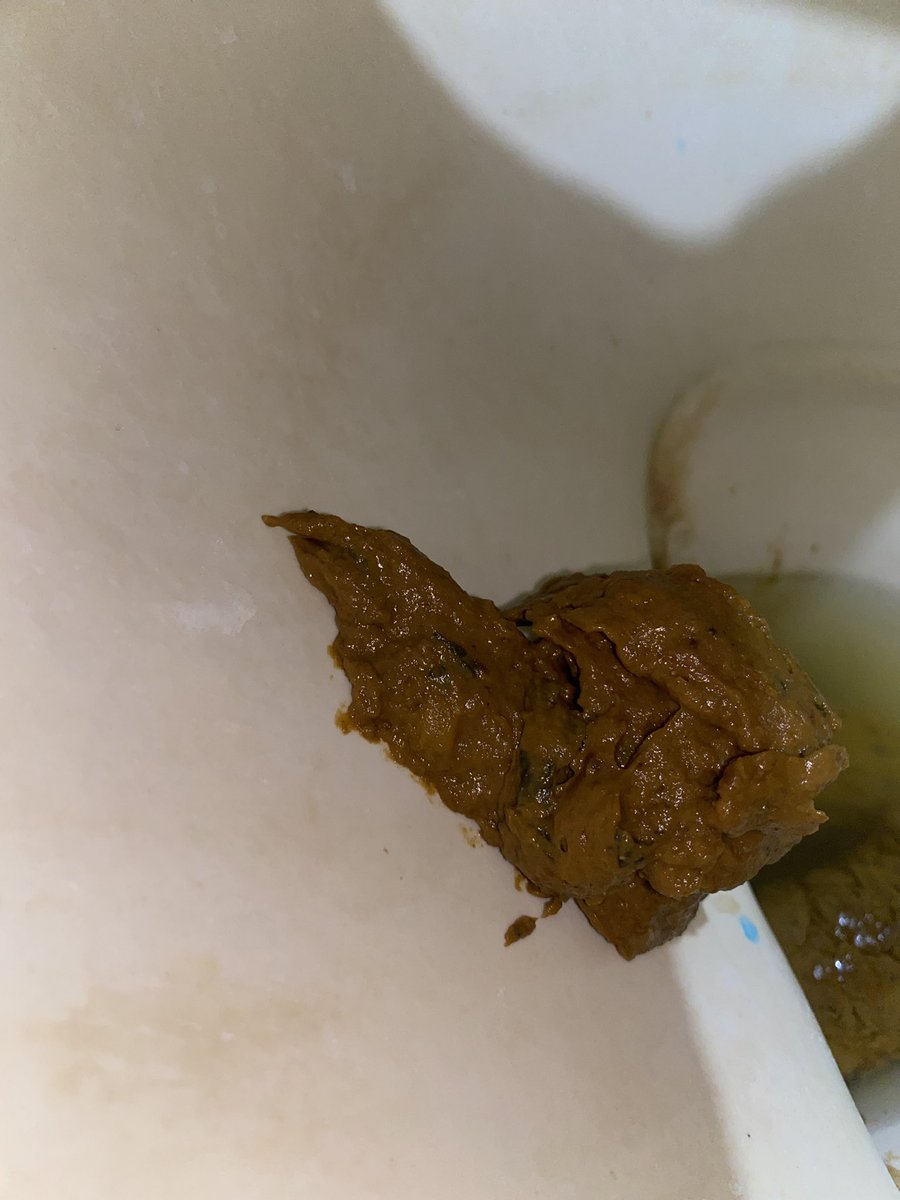 pigscatvzla's tweet photo. Una descarga tan potente que se desmoronó al impactar. Amo esta textura gruesa y abundante que cubre todo. ¡Una prueba de mi poder interno!
#scat #scatgay #scatmen #poop #poopgay #poopmem #cagando #hombrecagando #shitting #pooping #eatpoop #eatshit #piggay https://t.co/e8KiGSkWqu
