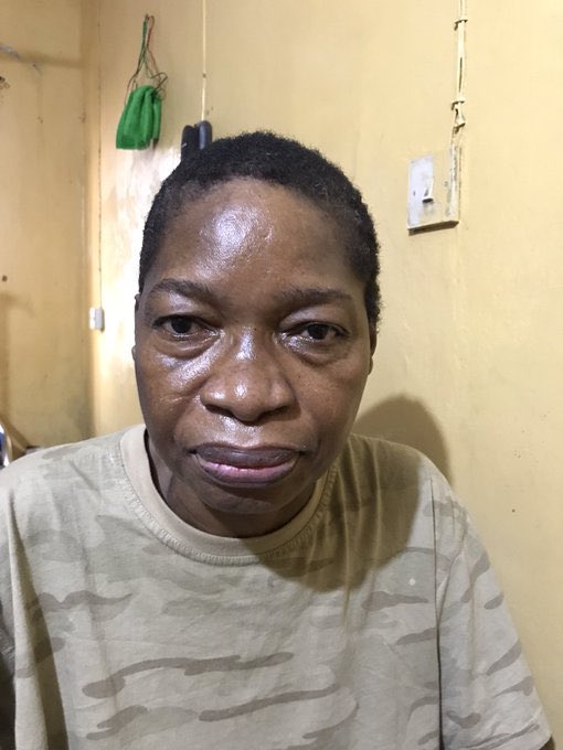 allaboutwura's tweet image. Day 37 of seeking financial help for my mum who was diagnosed with ALS. 

Her condition has no cure, although degenerative, treatment can help slow the progress and extend her survival. 

2343616614 UBA WuraolaOyenola

8140596483  OPAY AdesewaOyenola