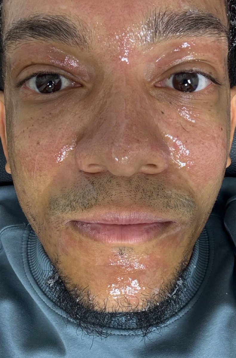 $wPond $PNDC $Pork When they kick you from a group chat for posting a pic  😂