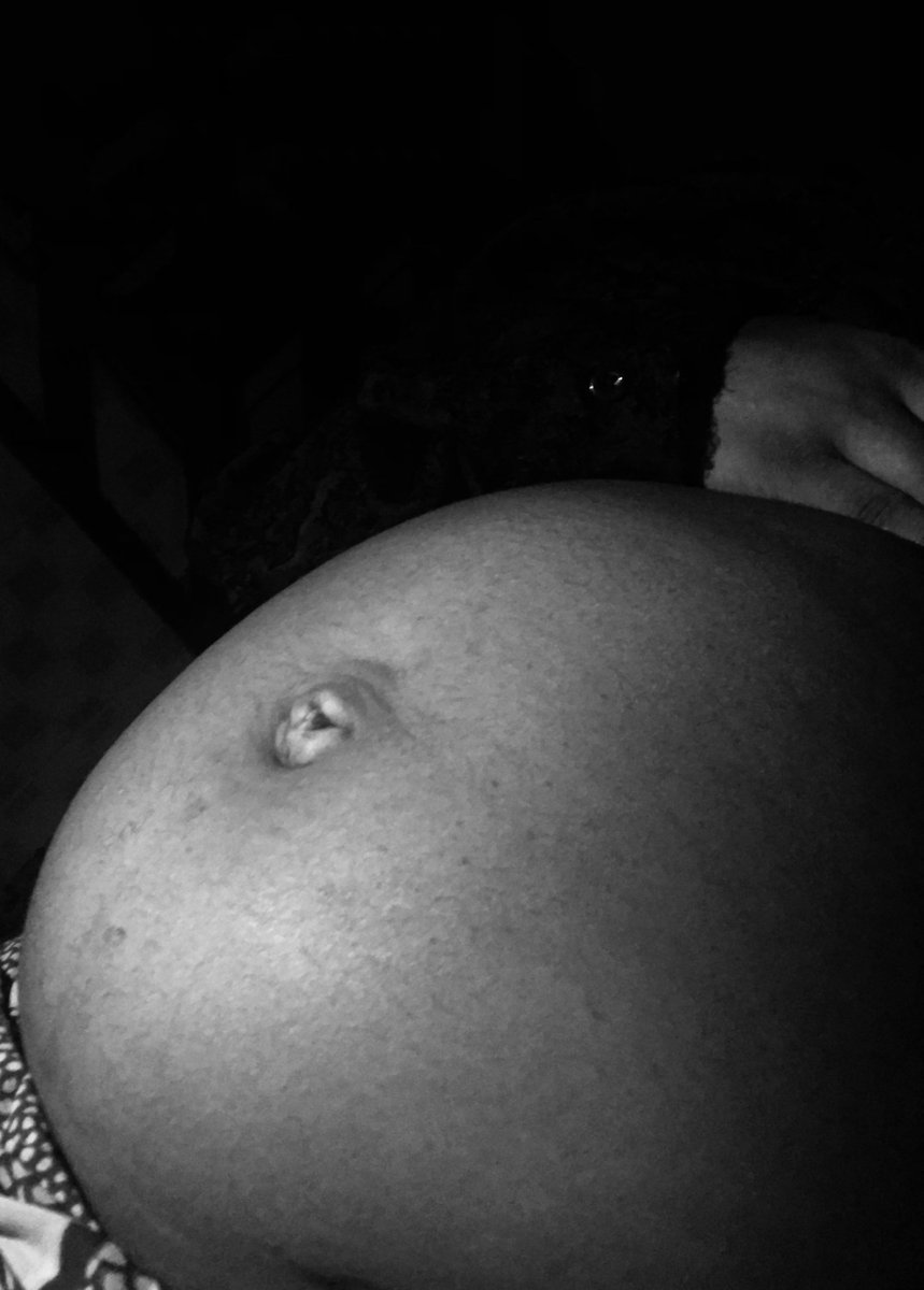 This is endometriosis . This is what endometriosis looks like, not just a big tummy, not just swelling, not just “period pain.” It is a chronic condition that affects millions of women around the world, including thousands of women here in Nigeria who are silently carrying this