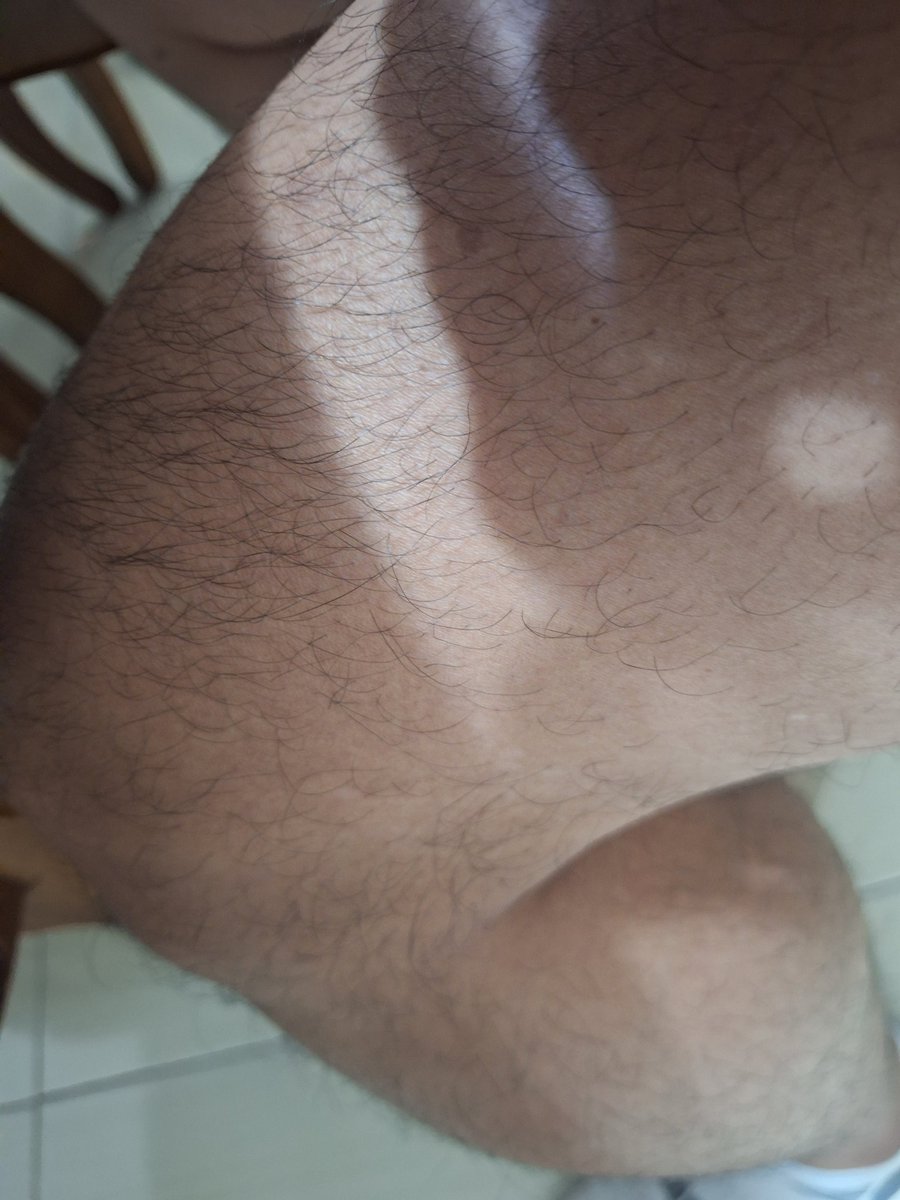 會喜歡腿毛或體毛很多的嗎？
我的的確很多毛……