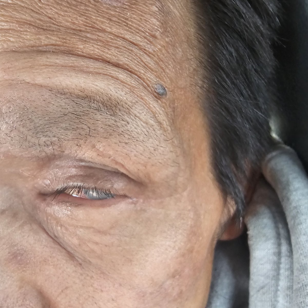 Hey <a href="/ABDanielleSmith/">Danielle Smith</a> With a blind 55yr man. Very fragile. On Aish. He has had all ten fingertips amputated. His residence burned down. Now in a motel. He states income support refuses to provide food or support. 
 He stated AISH told him to go to the food bank. Given cutbacks he