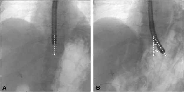 Image from iGIE (@iGIEjournal)