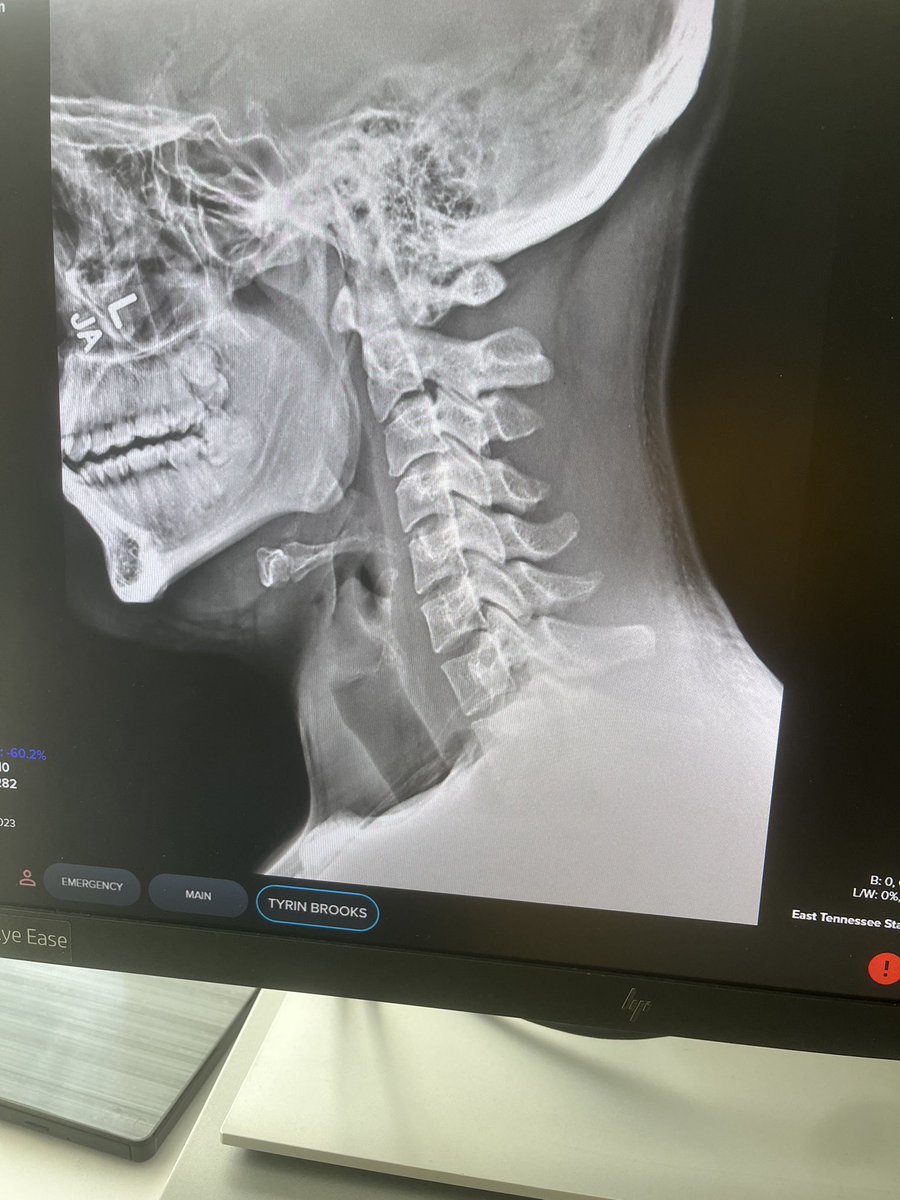 tyrin brooks tweet media