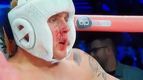 <a href="/HappyPunch/">Happy Punch</a> Deji did this to Jake Paul … 😱