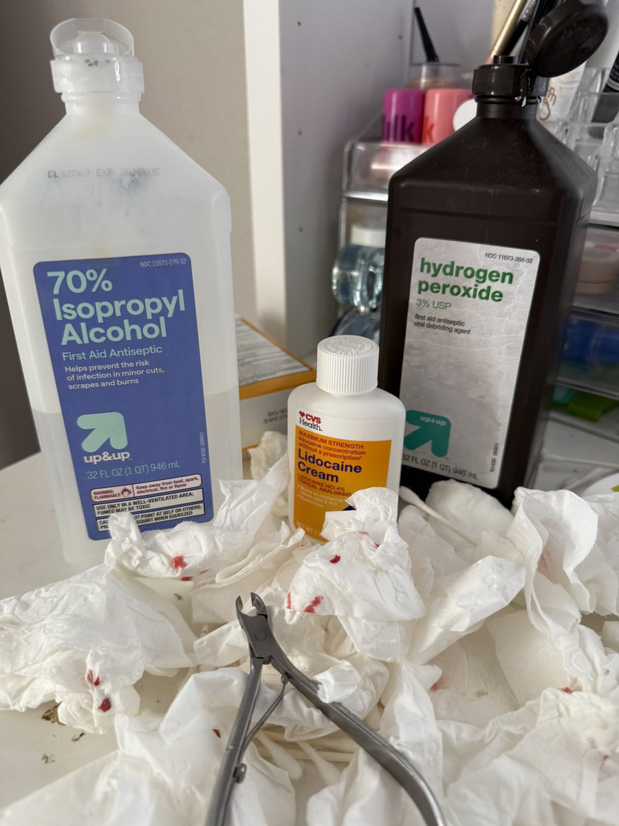 fxingalx's tweet image. Just did a minor surgery on myself