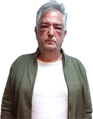 JorRausch's tweet image. #Calvete 
Recién operado (7/11) de los ojos 👀 y preso. 
#ANDIS : venían a terminar con la casta y el afano, y la justicia los investiga por las malditas prácticas políticas ladronas de siempre.
#MileiEsUnaEstafa  !