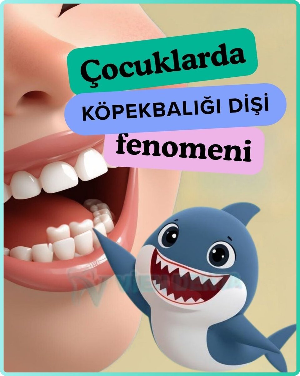 h_ugurel's tweet photo. Köpekbalığı Dişi Fenomeni nedir? Çocuklarınızın dişleriyle ilgili panik yapmadan önce bu bilgileri öğrenin. Daha fazla bilgi için: https://t.co/5usnUT820K #DişSağlığı #Çocuklar https://t.co/n3uHiSPpZK