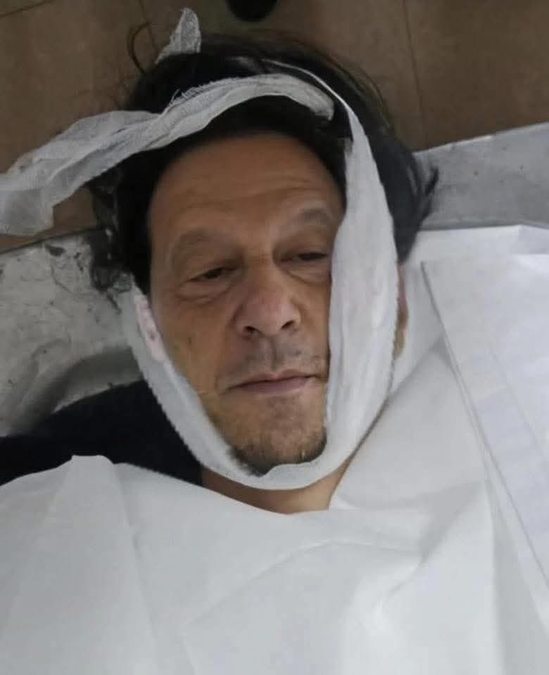 حال تیجاس۔                     بدحال تیجاس