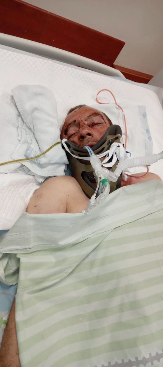 My brother is pleading with you to help him. You. Yes, you reading this.
I’m starving to death — don’t scroll in silence. 

If you're browsing, please leave a dot. It's just a dot.
chuffed.org/project/157957…