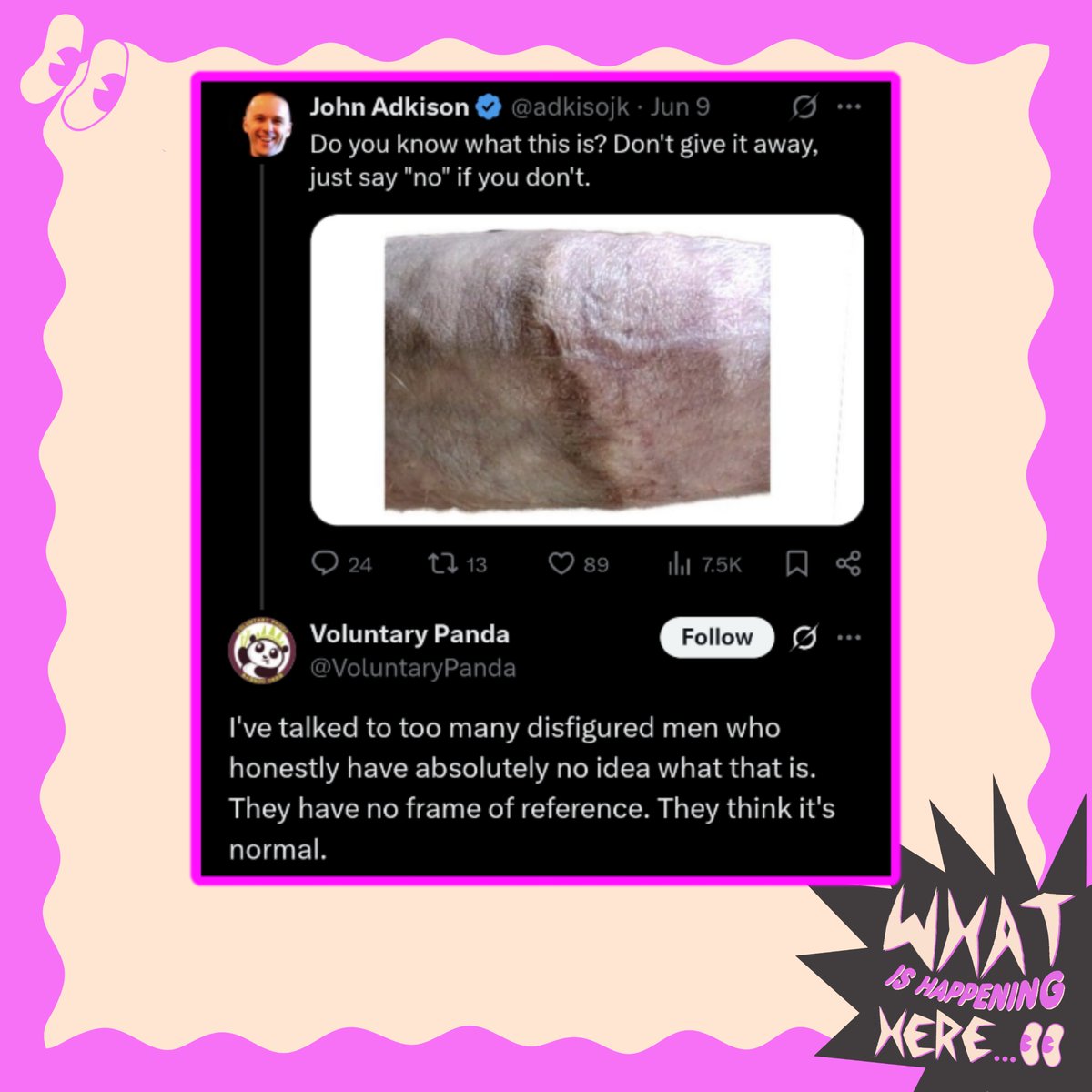 5ugger (foreskin) tweet media