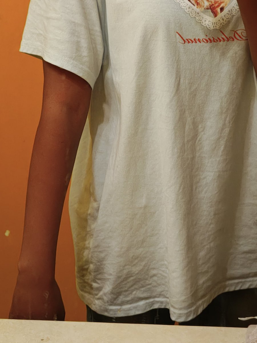 kinda proud of my arms lately but like ... if only the rest of my arm could be this skinny looool