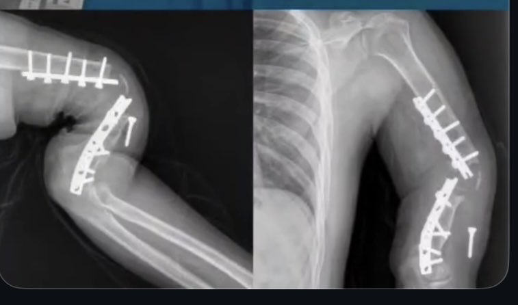 OGdukeneurosurg's tweet photo. Explain ? https://t.co/qsqkPdyftQ