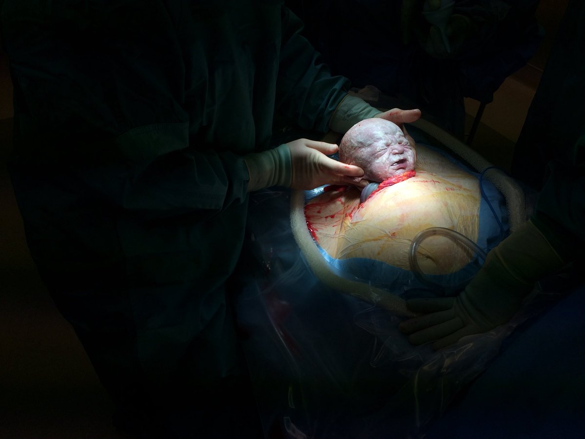 Absolutely the biggest load of BS and nastiness ever. My ex… the mother of 3 of my 4 kids… had this scar 3x because of reality… and she carried my boys, is an amazing woman… and a great mom. Best and greatest woman on earth. F*CK this BS…