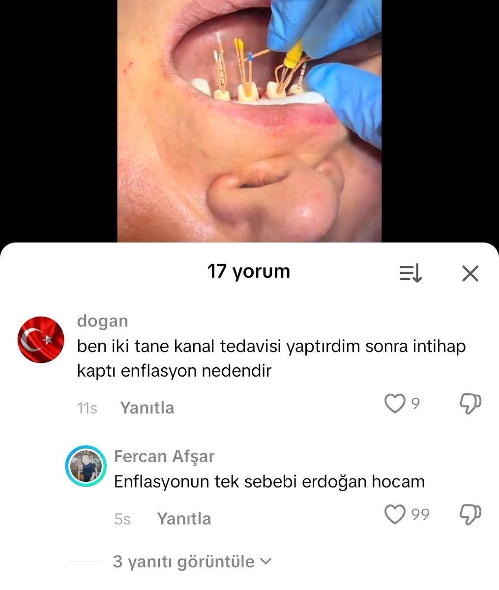 22.11.2025 tarihinde gördüğüm yorumla hiçbir alakam yoktur dhwkdhjdhjdjwkekwoqp