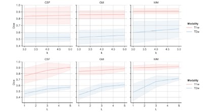 Radiology_AI's tweet image. Domain generalization of medical image segmentation models with random convolutions doi.org/10.1148/ryai.2… @TU_Muenchen #segmentation #DeepLearning #MachineLearning