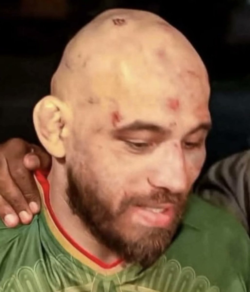 FightFanatic_'s tweet image. That time Diego Lopes sent Jean Silva home looking like Deadpool 😬

#UFC #MMATwitter