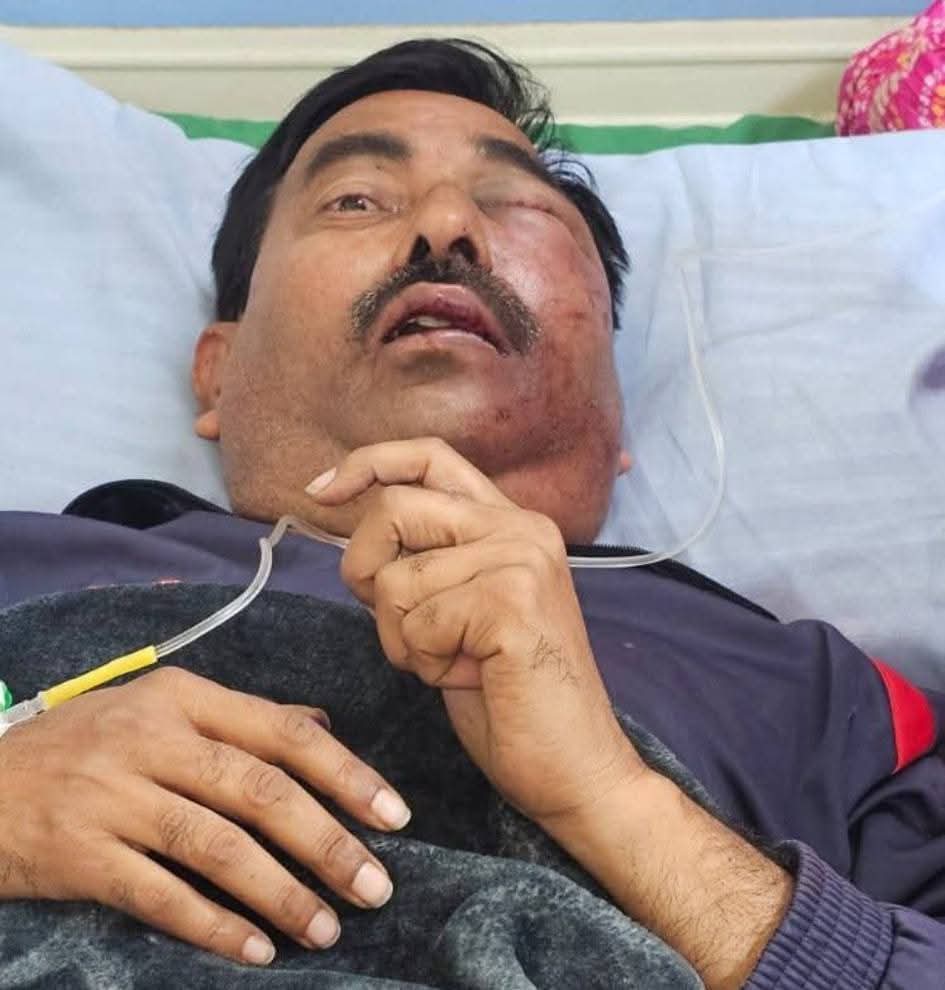 1vinci6le's tweet image. Sudarshan News journalist Pandit Sushil Awasthi was reporting on the corruption of a BJP leader!

The leader&apos;s men &quot;took him in the car and explained things to him with some kindness&quot;

This undemocratic bluffing by nationalist Sudarshan News journalist Pandit Sushil Awasthi…