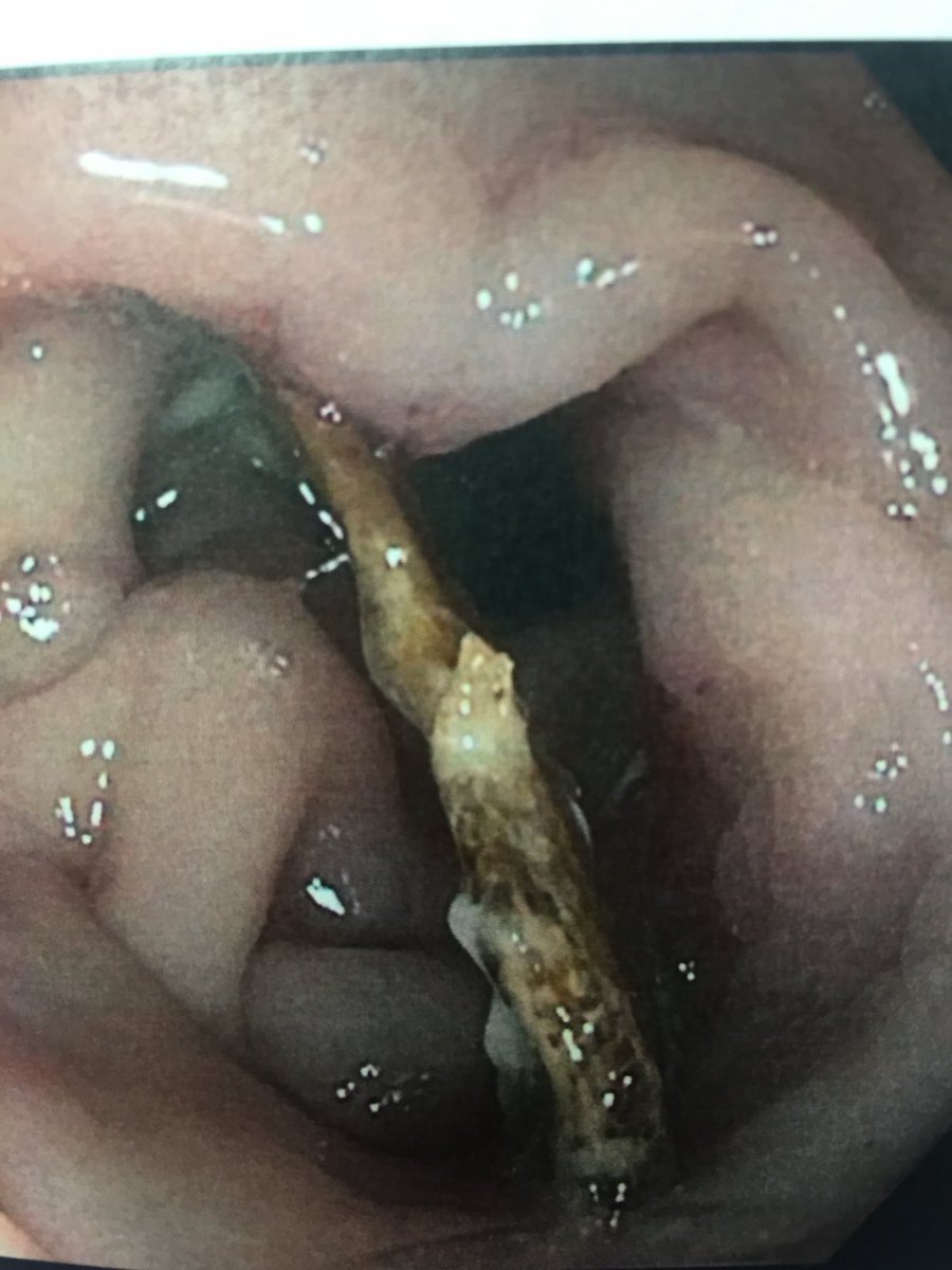 Manoj Mehta MD tweet media