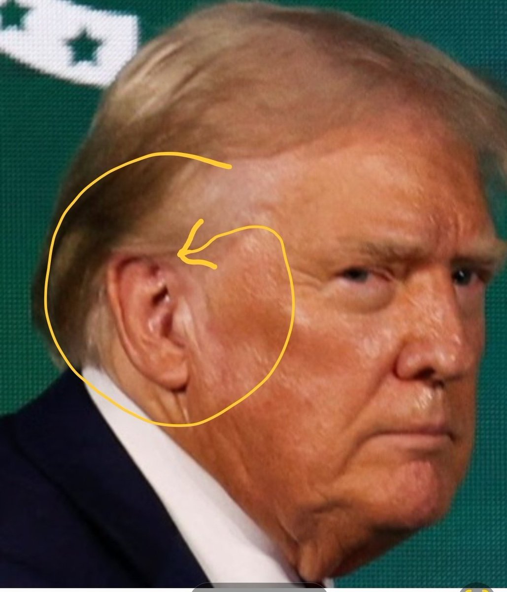 <a href="/Maga_Trigger/">The Maga Trigger</a> He either grew his ear lobe like a salamander 
OR