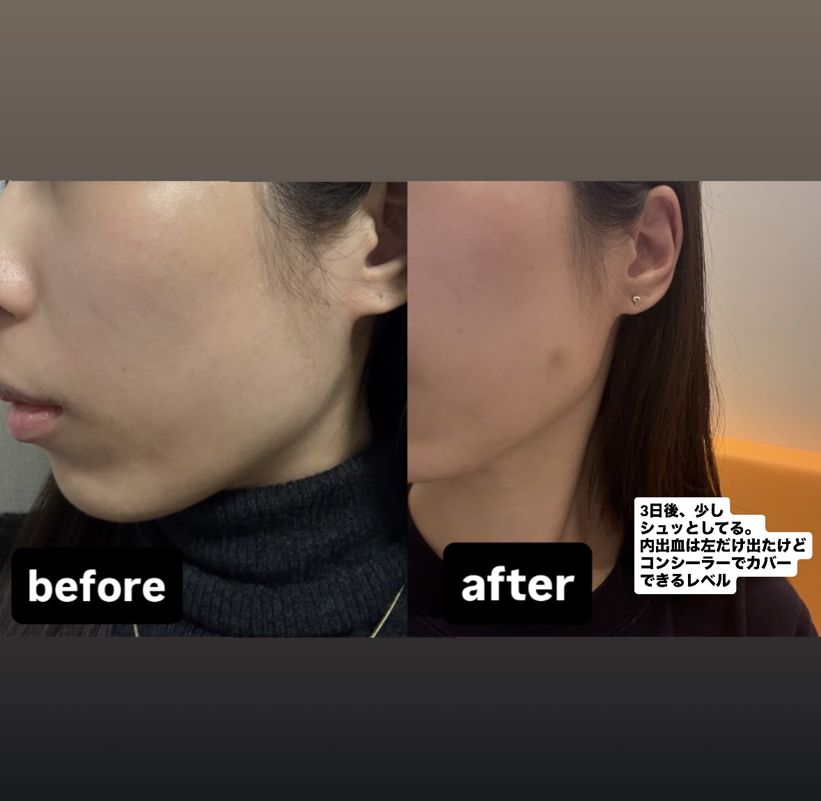 かるめら🐣 tweet media