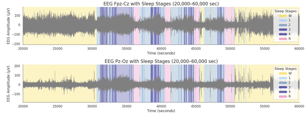 OnoLovesAI's tweet image. За тэгээд, мэдээж өөр салбарын дата юм болохоор зарим онцлог шинж чанарыг ойлгох хэрэг гарах юм. Энэ жишээ нь нэг хүний нэг шөнө унтаж байхад нь бичигдсэн 2 сувгийн #EEGdata 
Ягаанаар будсан нь REM, бас нойрны нэг цикл нь хөнгөнөөр эхлээд REM-ээр дуусдаг юм шиг харагдаж бгаа биз.