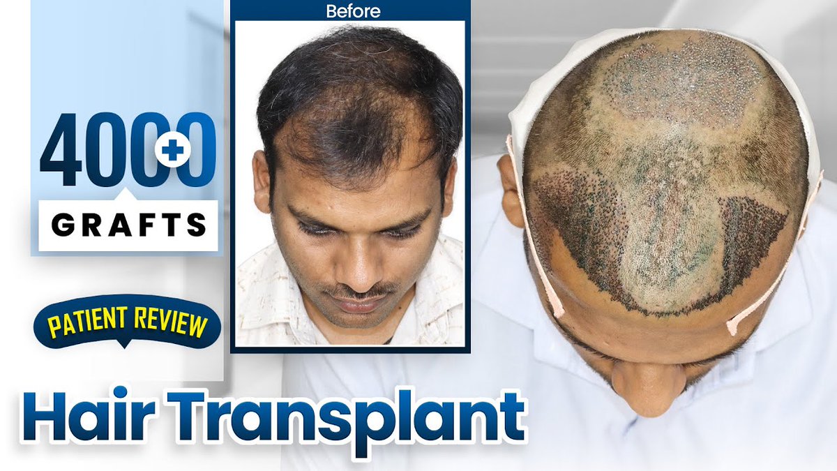 Hairfree and Hairgrow - Hair Transplant Clinic tweet media