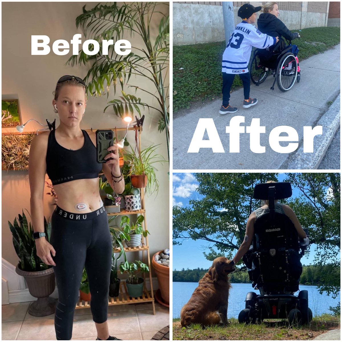 kcpollock's tweet image. 🕊️ I’m using trial by jury against Moderna in a $45 million lawsuit holding them accountable for paralyzing me. I’m fighting for medical freedom, transparency, and justice for all who were harmed.

I was offered Medical Assistance in Dying (MAID) instead of care. I know I’m not…