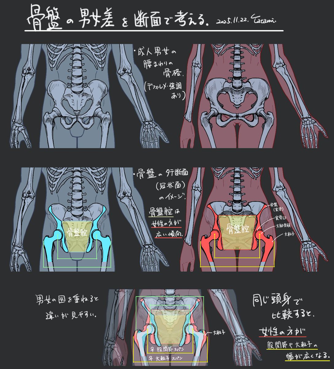 tatami_loop's tweet image. 骨盤の男女差と断面スケッチ

骨盤は「男女差」が大きい骨格として有名ですが、
断面図でアプローチするとまた面白いかと。

女性の外形の特徴を…
【機能】妊娠出産　【形状】骨盤腔：広い　【特徴】恥骨下角：広い、股関節スパン：広い、大転子スパン：広い…
