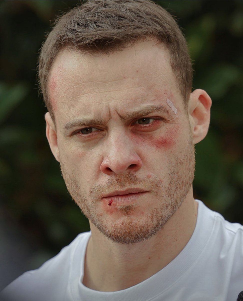 Aras … 🩹🤕🥺

#KeremBürsin 
#Çarpıntı