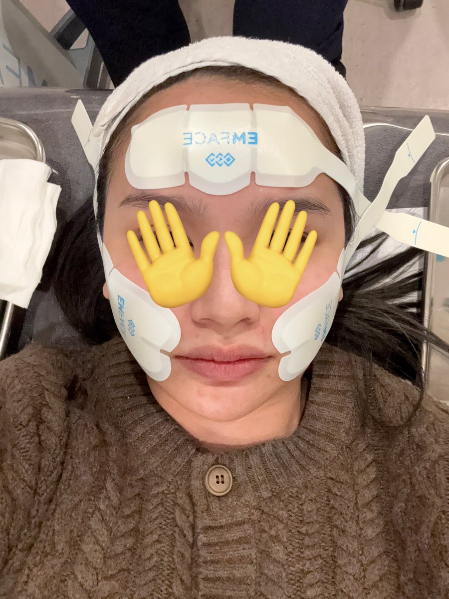 maybeitscms's tweet image. [Thread] รีวิวคลินิก + หัตถการที่ทำที่เกาหลี

คือทำมา 3 ครั้งละ ที่เดิม บ่อยกว่าที่ไทยอีก เพราะที่ไทยชอบเปลี่ยนคลินิก แต่มาเกาหลีชั้นเดินเข้า dr.evers  เลย มีล่ามคนไทย บริการดี ราคาถูกที่สุดเท่าที่เทียบมาหลาบๆเจ้า และหมอทำหัตการเอง (บางเจ้าที่ไทยเจอให้พนงทำ