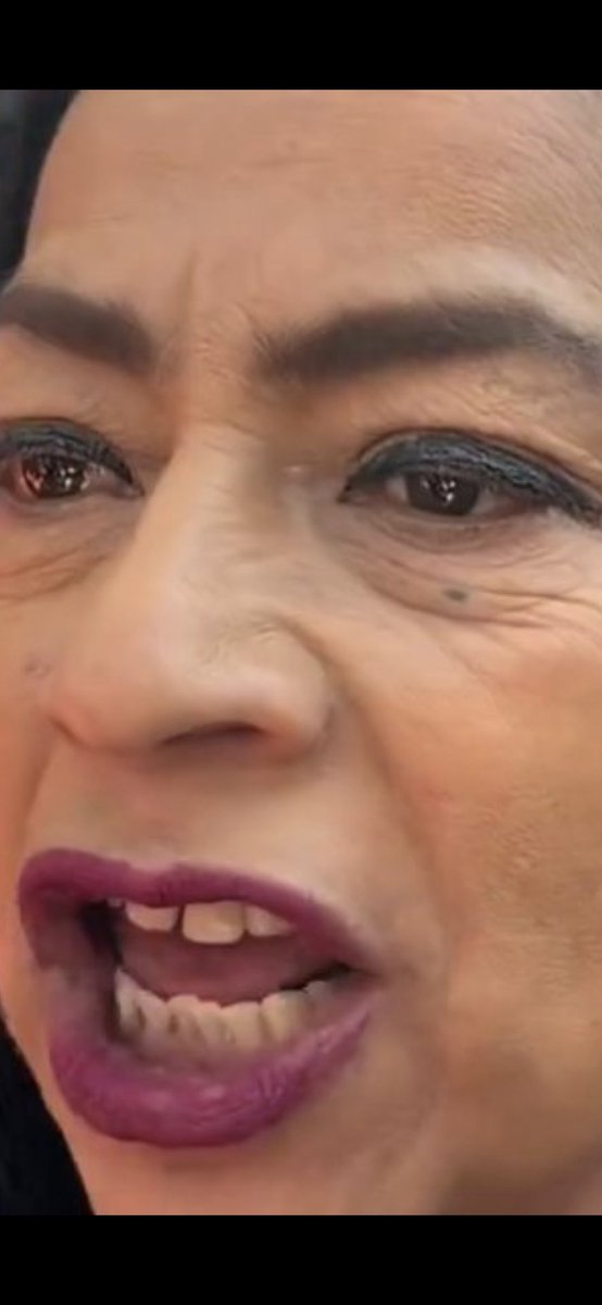 El rostro de la oposición en México es éste, define tal cual los sentimientos,  el odio, la vulgaridad, la fealdad, la ignorancia, lo grotesco, lo brutal, y lo violenta que es la derecha mexicana. 
Esta persona representa a toda la oposición. Mírense, petardos, es su espejo.