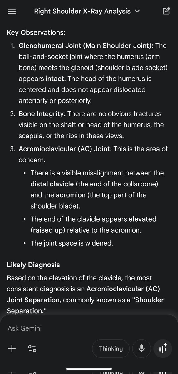 wizofbones's tweet image. Tried Gemini 3 and it also failed to interpret a simple xray.

So far, chatgpt, grok and Gemini have failed to diagnose this simple xray