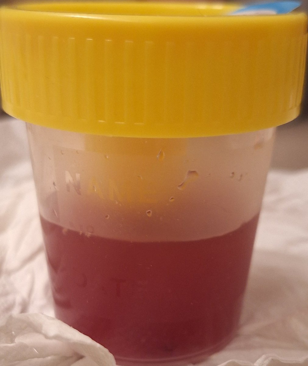 WivadeKo's tweet image. Goedemorgen Zaterdagochtend. 
Pffffff zh kuurtje. Lekker dan. 😮‍💨