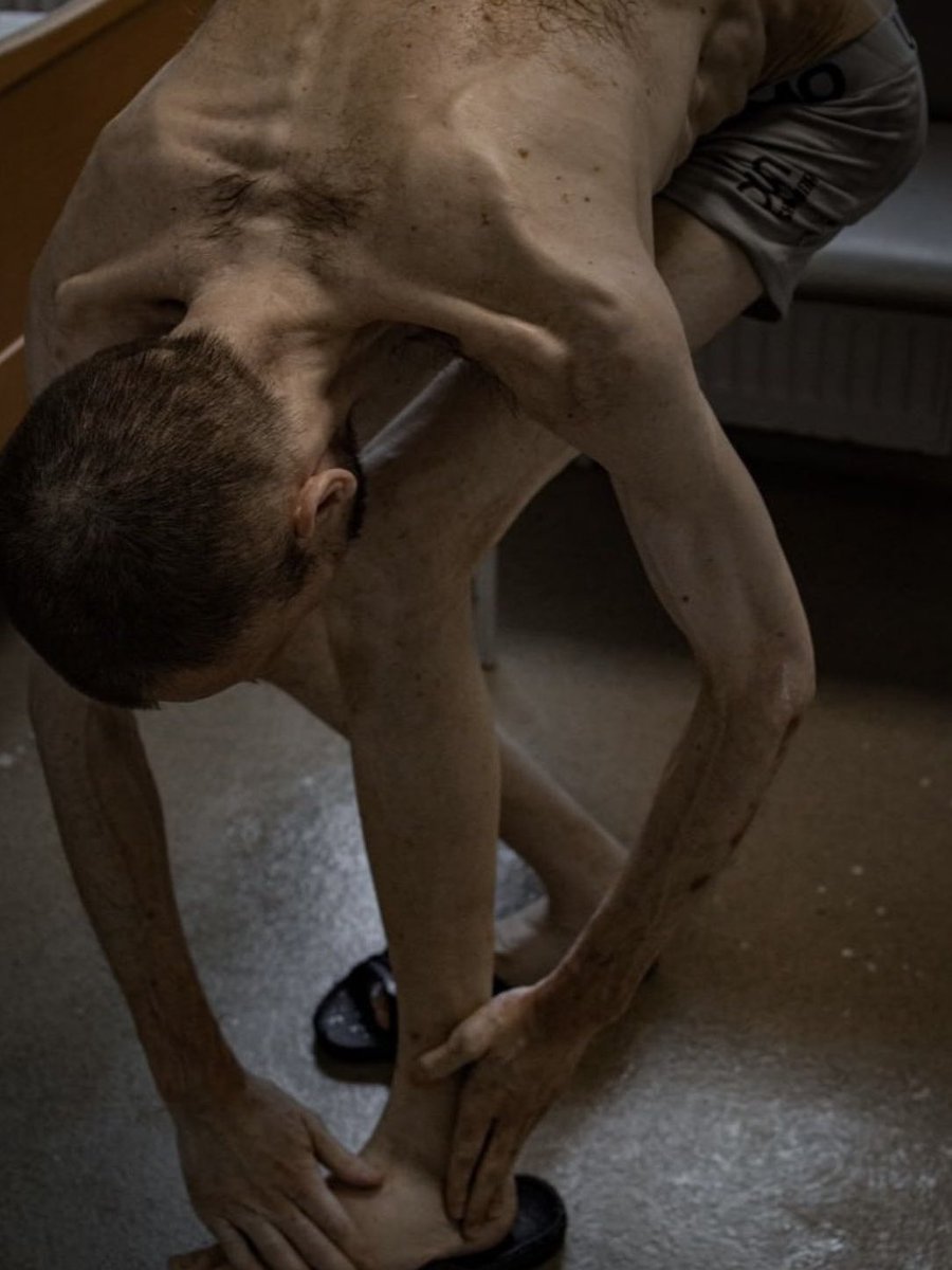 1932–1933 – moscow carried out the mass genocide of the occupied Ukrainian population by starving millions of people to death.

Today – one of the methods of torture in russian captivity is torture by starvation.

Photo: Roman Horilyk. He returned from russian captivity in 2024.