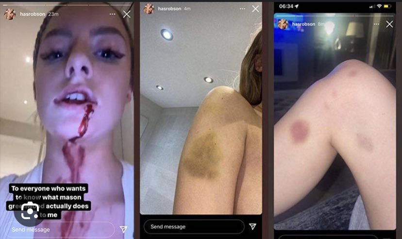 _IdeaLess's tweet image. La honte.