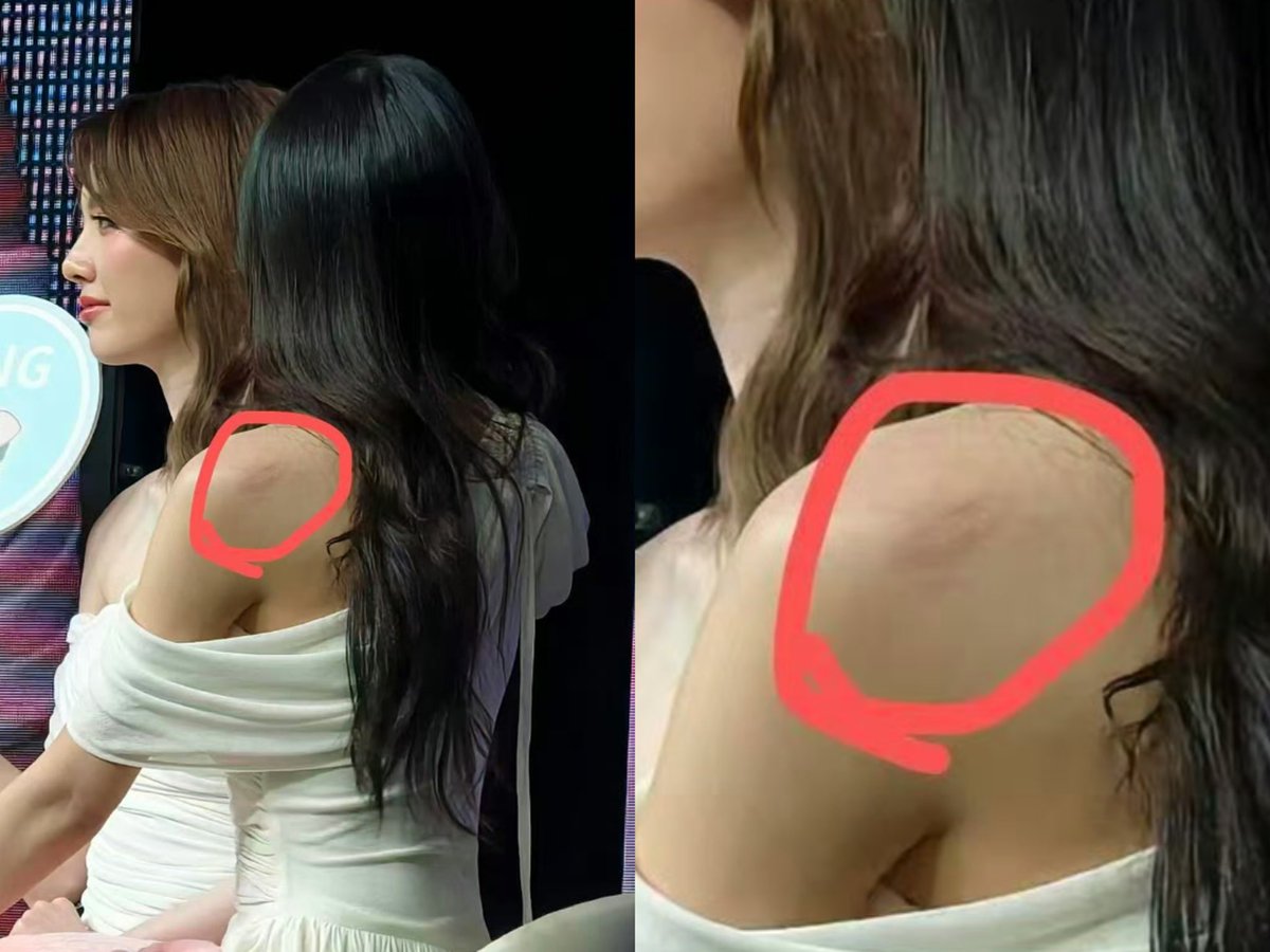 lovsubnews's tweet image. Could it be that this lipstick mark… is actually the backstage story they didn’t want to talk about on stage?

Hả!!!!! 🫵🫵🫵🫵🫵

LINGORM MACAU MEET D1 
#LingOrm3rdMeetMacauD1