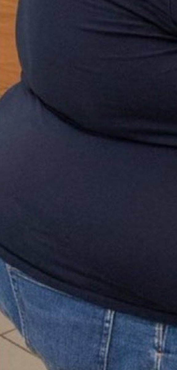 UnclePhuck's tweet photo. @SZade15 @RepFine He's got 3 bums 🤦🏻‍♂️ https://t.co/Jcv2efro0c